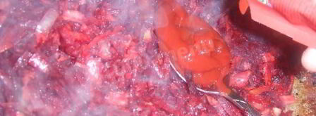 вкусный борщ на курином бульоне с курицей. Шаг 7