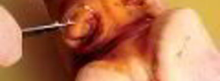 холодец гояжьей рульки и копыта. Шаг 4